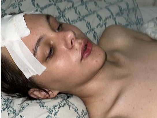 Кирилл после первой операции