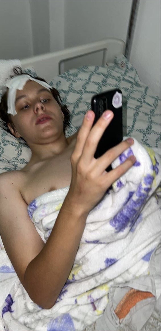 Кирилл после операции